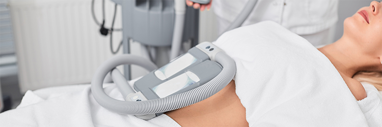 CoolSculpting Review: Can Cold Temps Burn Off Fat?